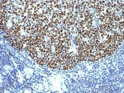 Bcl-6 Antibody (SPM602) - Azide and BSA Free, Novus Biologicals 100 &mu;g;